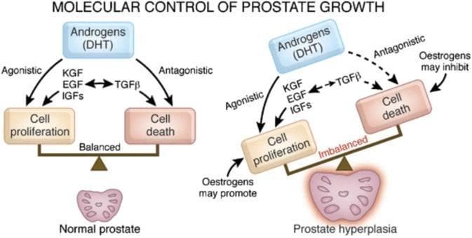 This medical schematic illustrates the pathophysiology of benign prostatic hyperplasia (BPH) compared to a normal prostate, focusing on the molecular signaling pathways that regulate tissue growth. The diagram is divided into two comparative sections: 'Normal prostate' and 'Prostate hyperplasia.' In a normal prostate, a balanced scale shows homeostatic equilibrium between cell proliferation and cell death. Androgens, primarily dihydrotestosterone (DHT), exert agonistic effects via growth factors (KGF, EGF, IGFs) to promote proliferation, and antagonistic effects via TGF-beta to promote apoptosis. In the prostate hyperplasia model, the scale is tilted toward proliferation, indicating an 'imbalanced' state. This pathological state is characterized by increased agonistic signaling and potential hormonal shifts, where estrogens may further promote cell proliferation and inhibit cell death. The illustration uses flow arrows to define the relationships between hormonal inputs (DHT, Oestrogens), intermediary growth factors (KGF, EGF, IGFs, TGF-beta), and the resulting physiological outcomes within the prostatic stroma and epithelium.