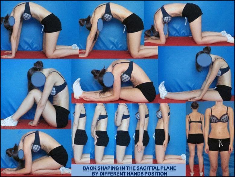 This composite educational patient photograph illustrates the 'back shaping' and symmetrical positioning techniques of the DoboMed method for scoliosis physiotherapy. The image demonstrates variations in sagittal plane spinal alignment across multiple postures, emphasizing active thoracic kyphotization and lumbar lordotization. The top row shows a patient in various quadruped (kneeling) positions; different hand and arm placements (flat hands, elbows on ground) are used to modulate thoracic convexity and vertebral mobilization. The middle sections depict sitting and long-sitting postures focusing on trunk elongation and sagittal correction. The bottom row showcases a sequence of kneeling and standing postures where subtle shifts in hand position and shoulder alignment are used to correct spinal deformity and improve postural awareness. The goal illustrated is 3D auto-correction to stabilize the primary curve and promote balanced trunk alignment. This resource is intended for physical therapists and medical students studying Conservative Treatment of Scoliosis (CTS) and Physiotherapeutic Specific Scoliosis Exercises (PSSE).