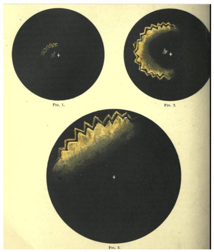 This sequence of three historical illustrations, labeled Figure 1 through Figure 3, depicts the temporal and spatial progression of a visual migraine aura (fortification spectra). Each figure presents a circular visual field with a central white fixation crosshair against a black background. The images demonstrate the characteristic 'march' of the aura from a central point toward the periphery. In Figure 1, a small, luminous, yellow-gold zig-zagged arc appears near the fixation point. In Figure 2, the disturbance has expanded into a larger crescent shape with a distinct crenellated or 'fortress-wall' border, accompanied by a trailing area of relative scotoma or blurred vision. Figure 3 illustrates the advanced stage, where the jagged, iridescent arc has migrated to the superior periphery of the visual field, significantly increasing in scale. These illustrations by James Mackenzie serve as a classic clinical representation of the neurological phenomenon of cortical spreading depression as perceived by a patient, highlighting the hallmark characteristics of teichopsia: jagged morphology, peripheral expansion, and associated visual field deficit.