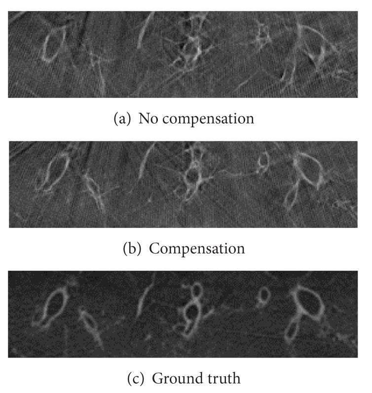 This diagnostic comparison image demonstrates the efficacy of respiratory motion compensation in pulmonary C-arm CT imaging. The visual includes three comparative slices (a, b, and c) of a porcine lung phantom scan captured over a 20-second period. Panel (a), labeled 'No compensation,' shows significant motion artifacts where the cross-sections of airways are severely distorted, blurred, and lack clear anatomical definition. Panel (b), labeled 'Compensation,' displays the results of a motion-compensated reconstruction algorithm; the contours of the airways are significantly improved and more accurately positioned, though some residual background noise remains. Panel (c), labeled 'Ground truth,' provides the static reference reconstruction, showing sharp, well-defined airway walls and clear anatomical structures with minimal noise. The comparison illustrates how algorithmic compensation for respiratory motion can restore diagnostic quality in thoracic imaging by reducing artifacts and improving the visibility of fine pulmonary details.