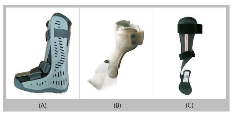A comparative clinical photograph showing three distinct types of ankle-foot orthoses (AFO) used in rehabilitative medicine. (A) Walking Boot: A rigid, pneumatic orthosis featuring a tall plastic shell with ventilation perforations, multiple Velcro strap closures, and a rocker-bottom sole designed for maximum immobilization and stable gait during acute injury recovery. (B) UD-Flex: A modern, semi-flexible AFO characterized by an anterior-facing shell and an open-heel design. It is constructed from lightweight plastic to facilitate natural ground reaction feedback and proprioception. (C) Carbon Fiber AFO (CFAFO): A streamlined, minimalist orthosis made from high-stiffness carbon fiber. It features a thin shell, open heel, and slender profile to optimize energy storage, weight reduction, and durability. These devices are utilized to manage conditions such as foot drop, spasticity, ligament injuries, and postoperative stabilization by controlling ankle joint kinematics.