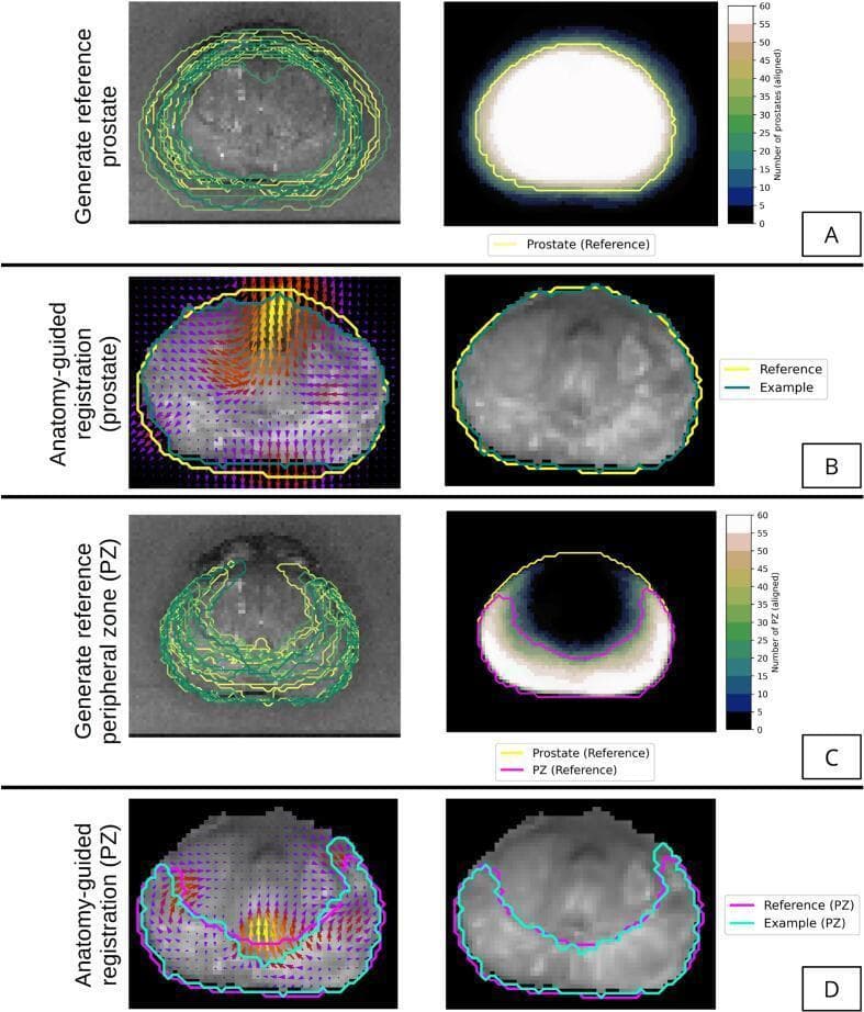 Educational diagram illustrating the medical imaging registration and model geometry framework for the prostate. The image is divided into four panels (A-D). Panels A and C demonstrate the generation of reference geometry for the whole prostate and the peripheral zone (PZ), respectively. These panels show multiple overlapping contours from different patients overlaid on axial T2-weighted MRI (left) and a corresponding heatmap (right) where color intensity (blue to white) represents the number of aligned structures, with the final reference template outlined in yellow. Panels B and D illustrate anatomy-guided deformable registration for the whole prostate and PZ. The left side of these panels displays a vector field map (color-coded arrows indicating deformation magnitude and direction) overlaid on the MRI, while the right side shows the resulting deformed MRI with aligned patient and reference boundaries. This methodology highlights advanced medical image processing techniques used to create a probabilistic anatomical atlas for prostate cancer research and clinical diagnostic mapping.