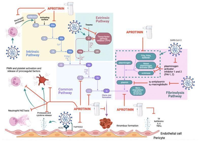 This pathophysiology diagram illustrates the complex relationship between SARS-CoV-2 infection, thromboinflammation, and the therapeutic inhibitory effects of aprotinin. The visual represents three integrated systems: the Intrinsic Pathway, Extrinsic Pathway, and Fibrinolysis Pathway. At the cellular level, the diagram shows SARS-CoV-2 interacting with endothelial ACE2 and TMPRSS2 receptors, triggering protease and cytokine release, neutrophil NETosis, and PMN/platelet activation. In the intrinsic pathway, kallikreins and factors XII through IX are shown sequentially activating. The extrinsic pathway is triggered by tissue factor (TF) release, which SARS-CoV-2 further enhances by inhibiting tissue factor pathway inhibitor (TFPI). Both pathways converge at the common pathway (Factor X to IIa/thrombin and I/fibrin), leading to thrombus formation. The fibrinolysis pathway depicts the conversion of plasminogen to plasmin via tPA and urokinase, resulting in D-dimer production. Aprotinin is depicted as a multi-modal inhibitor (indicated by red T-bars) acting on viral entry, neutrophil proteases, kallikreins, Factor XIIa, thrombin, and fibrinogen. The illustration emphasizes aprotinin’s role in restoring the balance between procoagulant and fibrinolytic forces in the context of COVID-19 coagulopathy.