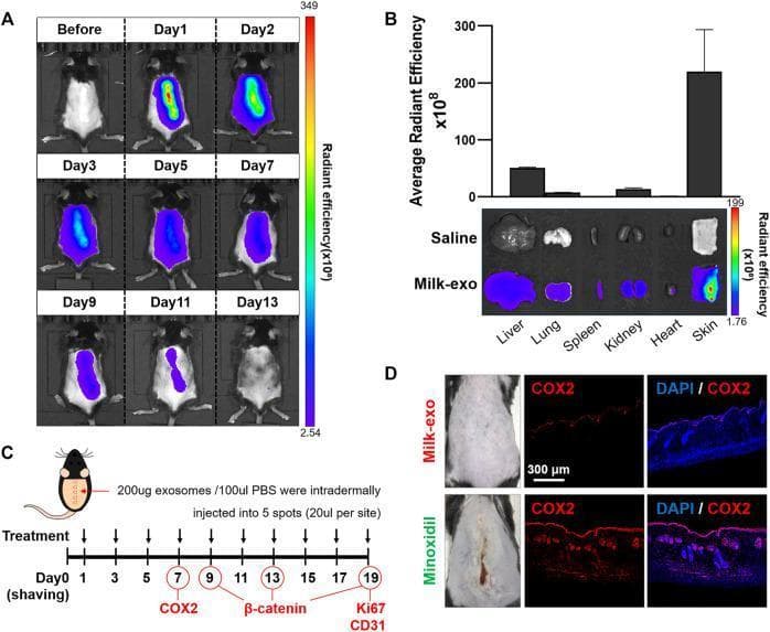 This composite image illustrates the in vivo and ex vivo biodistribution and inflammatory profile of colostrum-derived milk exosomes (Milk-exo) in a murine model. Panel A presents a longitudinal series of in vivo fluorescence imaging frames showing Cy5.5-NHS labeled exosomes over 13 days. Initially, a high-intensity signal (red/yellow radiant efficiency) is localized at the intradermal injection site, which progressively dissipates and shifts to lower intensity (blue/purple) until complete clearance by Day 13. Panel B includes a bar graph and corresponding ex vivo organ imaging comparing Saline and Milk-exo groups at 2 days post-injection. The Milk-exo group shows significantly higher radiant efficiency, predominantly localized in the skin, with secondary distribution to the liver, lungs, and kidneys. Panel C displays the experimental timeline and injection protocol. Panel D provides clinical photographs and immunofluorescence histology sections of mouse skin treated with Milk-exo vs. Minoxidil. The staining compares COX2 expression (red) with DAPI nuclear counterstaining (blue), demonstrating that Milk-exo treatment maintains low COX2 expression compared to the high inflammatory response observed in the Minoxidil group.