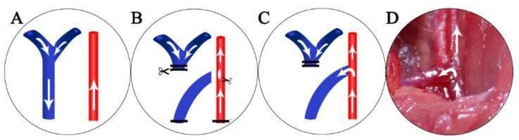 This composite image illustrates the surgical creation of an autologous arteriovenous fistula (AVF), specifically an end-of-vein to side-of-artery anastomosis. Panels A-C are schematic diagrams showing the external jugular vein (blue) and common carotid artery (red) with white arrows indicating blood flow direction. Panel A displays the initial anatomy with parallel vessels. Panel B illustrates the surgical manipulation, including the ligation and transection of the distal vein and a longitudinal arteriotomy. Panel C demonstrates the completed anastomosis with the proximal vein end sutured to the lateral wall of the artery, showing redirected arterial blood flow into the venous system. Panel D is a corresponding clinical photograph of the microsurgical procedure in a rat model, showing the moist, reddish-pink surgical site with the completed vascular connection and integrated arrows indicating post-anastomosis patency. This figure serves as an educational tool for understanding vascular surgery techniques and hemodynamics in AVF formation for hemodialysis research.
