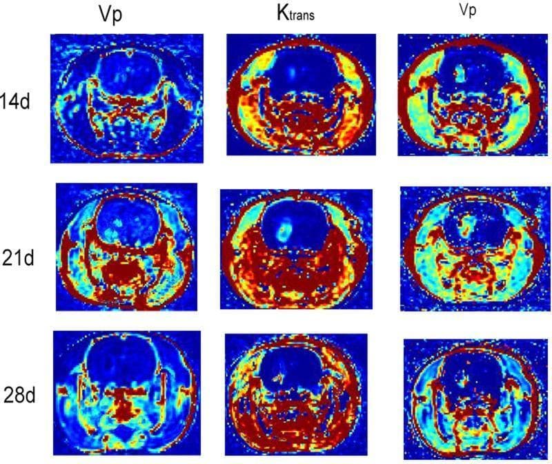 A series of nine axial dynamic contrast-enhanced (DCE) MRI parametric maps illustrating tumor permeability and perfusion in a C6 glioma model. The images are arranged in a grid showing three time points (14 days, 21 days, and 28 days post-transplantation) across columns labeled Vp (plasma volume fraction) and Ktrans (volume transfer coefficient). The color-coded maps utilize a jet scale where blue represents low values and red/yellow represents high values. At 14d, the Ktrans maps show a central area of low permeability (blue) surrounded by a high-permeability peripheral ring (red/yellow). By 21d, the Ktrans maps demonstrate a significant expansion of the high-permeability red zones, coinciding with increased tumor volume. The Vp maps show a heterogeneous increase in vascular plasma volume at 21d, which appears to become more diffuse and slightly less intense by 28d. These diagnostic images track the longitudinal progression of tumor angiogenesis and vascular permeability within the neuro-oncological context.