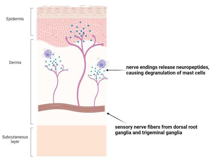 An anatomical diagram illustrating neuro-immune crosstalk within the skin layers, created for medical education. The cross-section depicts three primary layers: the epidermis (top, showing stratified keratinocytes), the dermis (middle, containing connective tissue and specialized cells), and the subcutaneous layer (bottom). The illustration highlights the pathway of sensory nerve fibers originating from the dorsal root ganglia and trigeminal ganglia. These branched nerve fibers extend through the dermis toward the dermo-epidermal junction. The diagram specifically demonstrates the release of neuropeptides (represented by small blue granules) from terminal nerve endings. This release is shown interacting with dermal mast cells, triggering their degranulation. This visual focuses on the signaling pathway between the nervous and immune systems, explaining how neural stimuli can amplify inflammatory responses and contribute to clinical symptoms such as pruritus (itching) in dermatological conditions.