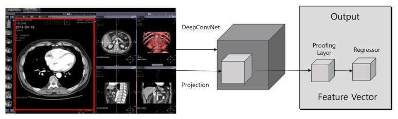 This infographic combines clinical diagnostic imaging with a machine learning architectural diagram, illustrating a Faster R-CNN-based cloud filter system for medical data processing. On the left, a multi-pane interface displays various cross-sectional radiological images. The primary highlighted pane (red border) shows an axial computed tomography (CT) scan of the human thorax at the level of the heart, clearly demonstrating the cardiac chambers, lungs, and spine. Adjacent panes show sagittal and axial views of abdominal structures, along with a 3D volume-rendered image of the thoracic cage and abdominal vasculature. To the right, a computational pipeline outlines the feature extraction process. Input images are fed through 'DeepConvNet' and 'Projection' stages into a central 3D data cube. This feeds into a 'Feature Vector' block containing a 'Proofing Layer' and a 'Regressor', ultimately leading to the 'Output'. This diagram explains the integration of deep learning architectures in automating the verification and reading of EMR and PACS data to reduce clinical diagnostic errors.