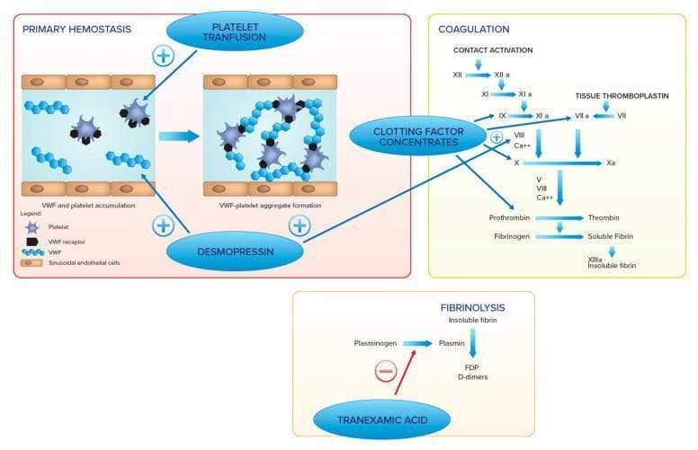 A medical infographic and pathway diagram detailing the mechanisms of hemostasis and associated therapeutic interventions. The content is divided into three main sections: Primary Hemostasis, Coagulation (Secondary Hemostasis), and Fibrinolysis. The 'Primary Hemostasis' section illustrates the transition from von Willebrand Factor (VWF) and platelet accumulation to VWF-platelet aggregate formation within a vessel lined by sinusoidal endothelial cells; it highlights Platelet Transfusion and Desmopressin as therapeutic options to enhance this stage. The 'Coagulation' section depicts the classical cascade, including the intrinsic (contact activation) pathway through Factor XII, XI, and IX, and the extrinsic pathway via Tissue Thromboplastin and Factor VII. These pathways converge on the common pathway (Factor Xa, Prothrombin to Thrombin, and Fibrinogen to Fibrin), with Clotting Factor Concentrates and Desmopressin indicated as interventions. The 'Fibrinolysis' section shows the conversion of Plasminogen to Plasmin leading to the breakdown of insoluble fibrin into D-dimers, where Tranexamic Acid is shown as an inhibitory agent. The diagram serves as an educational summary of hematologic pathways and pharmacological targets for managing coagulopathies.