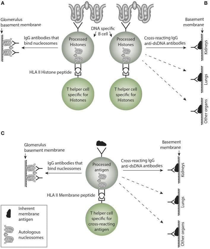 This medical illustration depicts the pathophysiology of autoimmune antibody responses involving nucleosomes and the glomerular basement membrane (GBM). The diagram is divided into three sections (A, B, and C). Section A shows a DNA-specific B cell presenting processed histones via HLA Class II molecules to a histone-specific T helper cell, leading to the production of IgG antibodies that bind nucleosomes and target autologous nucleosomes associated with the GBM. Section B illustrates a similar cellular interaction resulting in cross-reacting IgG anti-dsDNA antibodies that target the basement membranes of kidneys, lungs, and other organs. Section C demonstrates a B cell presenting processed inherent membrane antigens, resulting in both IgG antibodies that bind nucleosomes on the GBM and cross-reacting IgG anti-dsDNA antibodies affecting multiple organ systems. Key structures illustrated include nucleosomes, B cell receptors, HLA II peptides, T helper cells, and specific tissue targets like the kidney's glomerular basement membrane. This visual highlights the mechanisms of cross-reactivity and direct immune targeting in conditions such as systemic lupus erythematosus and Goodpasture-like syndromes.