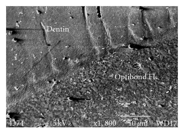 Scanning electron micrograph (SEM) at 1,800x magnification showing the cross-sectional interface between human dentin and the dental adhesive Optibond FL. The image illustrates the formation of a hybrid layer, a key educational concept in restorative dentistry and biomaterials. The dentin region occupies the upper portion of the frame, characterized by a relatively smooth, homogenous texture with subtle parallel striations and minor imperfections. The lower portion displays the Optibond FL material, which exhibits a highly granular and heterogeneous appearance due to the presence of numerous small, bright filler particles. A distinct transition zone is visible where the adhesive infiltrates the demineralized dentin substrate to form the resin-dentin interface. The micrograph includes technical metadata such as a 10 μm scale bar, 5kV accelerating voltage, and WD17 working distance, providing context for the microscopic evaluation of bond integrity and failure modes in dental luting cements.