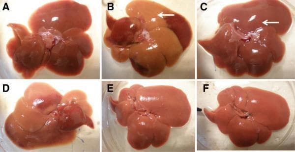 Comparison chart featuring six macroscopic clinical photographs (A–F) of rat livers, serving as a preclinical model for drug-induced liver injury (DILI) and hepatoprotection. (A) Control group: Displays a normal, healthy liver with smooth texture and uniform dark maroon coloration. (B) Paracetamol-intoxicated group (3 g/kg): Shows severe hepatotoxicity characterized by large areas of pale tan/brown discoloration (white arrow) and loss of normal vascular appearance, indicative of massive necrosis. (C) Positive control (200 mg/kg silymarin + paracetamol): Demonstrates significant protection, appearing similar to the control with only a localized tiny hemorrhage spot (white arrow). (D–F) Experimental groups (MEMM pre-treatment at 50, 250, and 500 mg/kg + paracetamol): Illustrates a dose-dependent hepatoprotective effect. The low-dose liver (D) remains pale and discolored, while the higher doses (E and F) show a progressive return to normal morphology, smooth surface integrity, and healthy reddish-brown coloration. This series is used in pharmacology and toxicology to visually assess the efficacy of plant extracts in mitigating chemical-induced hepatic damage.