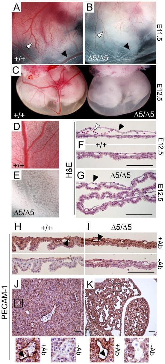 This composite figure presents a comparative developmental study of mouse embryos (wild-type +/+ vs. PiT1Δ5/Δ5 mutant) at stages E11.5 and E12.5, focusing on yolk sac vasculature and liver morphology. Gross clinical photographs (A–E) demonstrate that while the mutant PiT1Δ5/Δ5 embryos develop a normal tree-like vascular architecture, the vessels appear pale or translucent and are significantly devoid of red blood cells compared to the vibrant red vessels of the wild-type, indicating profound anemia. Histological analysis via H&E staining (F–G) of E12.5 yolk sac cross-sections confirms the presence of vascular channels (black arrows) in both genotypes, but highlights the absence of intraluminal erythrocytes (white arrows) in the mutant. Immunohistochemistry (IHC) using anti-PECAM-1 (CD31) staining (H–K) identifies intact endothelial cell layers in both the yolk sac and fetal liver of mutant embryos, suggesting that the primary defect is not structural vasculogenesis but rather related to definitive erythropoiesis. High-magnification liver sections (J–K) show increased vessel density in the mutant liver relative to its severely reduced organ size.