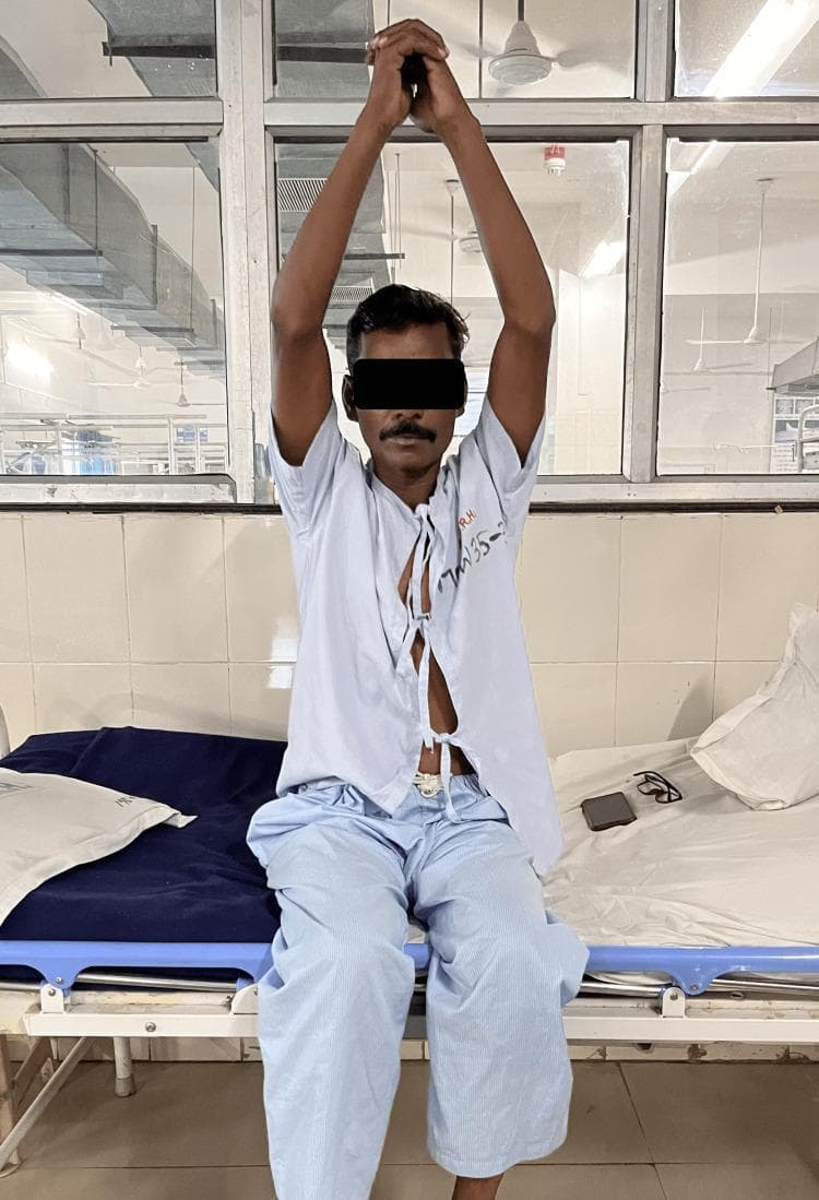 A clinical photograph of an adult male patient demonstrating thoracic expansion exercises as part of a post-operative respiratory physiotherapy regimen. The patient is sitting upright on a hospital bed with his arms extended vertically and hands clasped above his head, a position designed to maximize rib cage elevation and lung volume expansion. He is wearing an open hospital gown, and the setting includes typical clinical markers such as a blue medical mattress and tiled hospital walls. This visual illustrates active chest physical therapy techniques aimed at improving ventilation, reducing the work of breathing, and increasing exercise tolerance following procedures like intercostal drainage (ICD) tube removal. The image serves as a clinical guide for healthcare students and professionals in pulmonary rehabilitation and physiotherapy management.