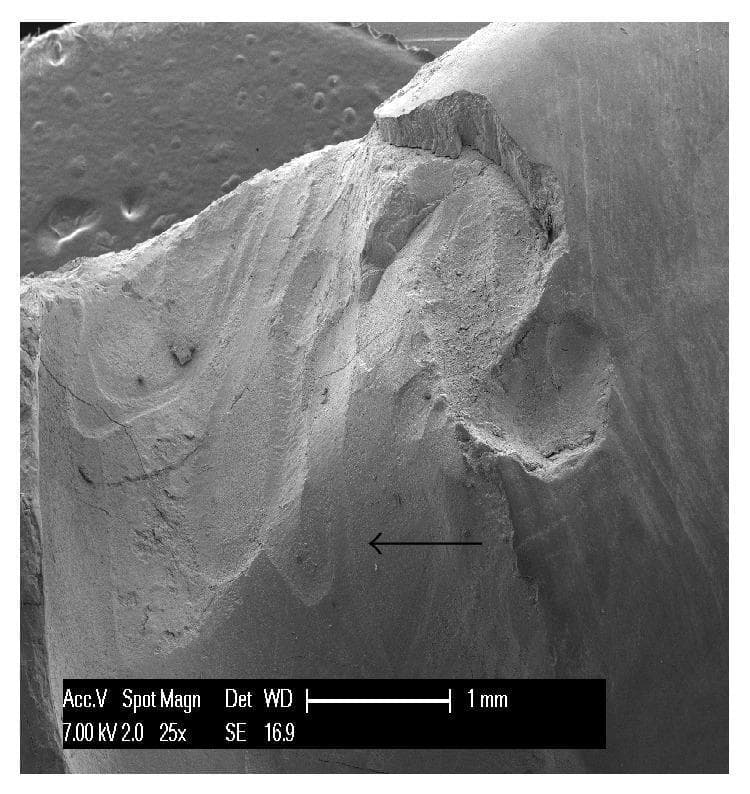 Scanning Electron Micrograph (SEM) at 25x magnification showing a non-carious cervical lesion (NCCL) in an upper human canine. The image displays a complex wedge-shaped abfraction lesion characterized by a deep, irregular morphology with clearly defined margins. Key visual features include multiple internal cavities and partially overlapping furrows. The surface texture exhibits a smear layer and distinctive mechanical wear patterns, specifically parallel striations alternating with protruding crests, indicating a superimposed process of mechanical abrasion. A black arrow points toward a prominent cavity within the lesion where these striations are visible. The imaging highlights the structural damage to dental hard tissues—enamel and dentin—and illustrates the multifactorial nature of tooth wear where tensile stress (abfraction) and physical friction (abrasion) coexist. This diagnostic image is intended for dental education regarding the classification and microscopic analysis of non-carious tooth loss.
