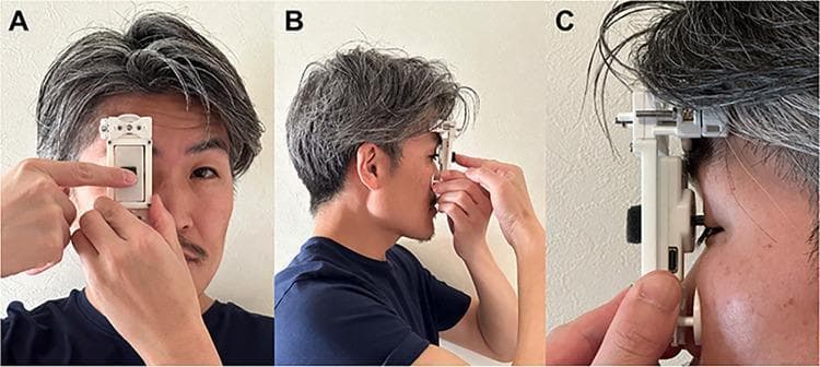A series of clinical photographs illustrating the use of the TapEye tonometer (TET) for intraocular pressure (IOP) measurement through the eyelid. Panel A (front view) shows the patient holding the device against the right orbit, using the index finger of the same hand to depress the measurement button. Panel B (lateral view) demonstrates the vertical orientation of the device, which is stabilized against the forehead and nose. Panel C provides a magnified lateral view showing the tonometer's probe tip in contact with the naturally closed upper eyelid. The probe is positioned approximately 1 to 3 mm superior to the lid margin, aligning with the corneal center. This method represents trans-palpebral tonometry, an alternative to Goldmann applanation tonometry (GAT) that does not require topical anesthesia or direct corneal contact. The educational focus is on proper device positioning, hand placement, and anatomical landmarks for non-invasive IOP monitoring.