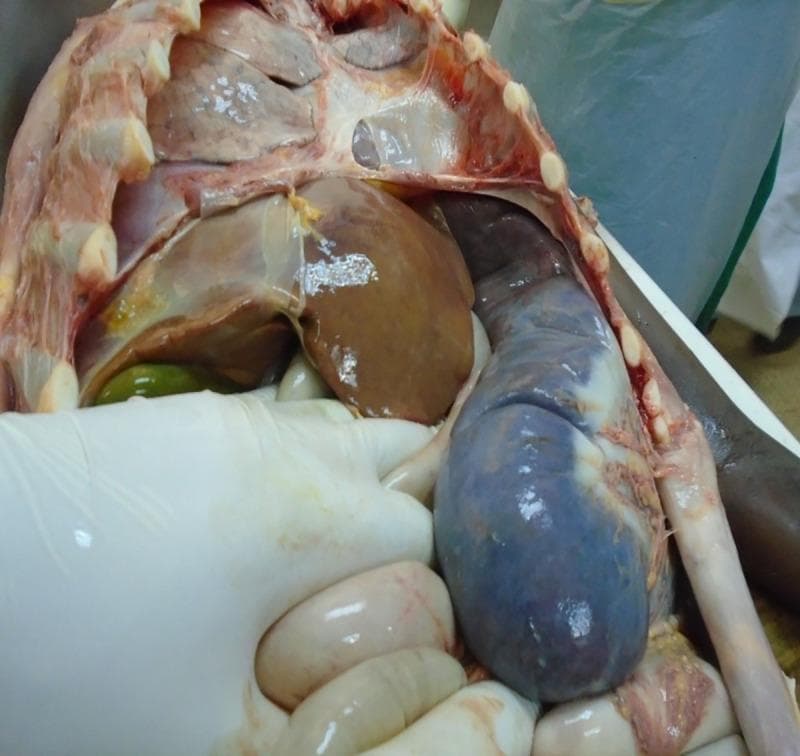 This clinical photograph captures a postmortem examination of the abdominal and thoracic cavities, demonstrating severe visceral manifestations of visceral leishmaniasis. The primary focus is on massive splenomegaly; the spleen is markedly enlarged, extending deep into the abdominal cavity with a characteristic bluish-purple, mottled discoloration and a smooth but distorted capsule. Adjacent to it, significant hepatomegaly is evident; the liver appears enlarged with a brown, smooth, and slightly reflective serosal surface. Other visible structures include the dissected rib cage at the superior margin, a distended gallbladder with a greenish hue located inferior to the liver, and pale, pinkish intestinal loops partially retracted by a gloved hand. The image serves as a pathological illustration of the systemic impact of Leishmania infection on the reticuloendothelial system, specifically highlighting the extreme organomegaly that occurs in advanced or poorly responsive cases.