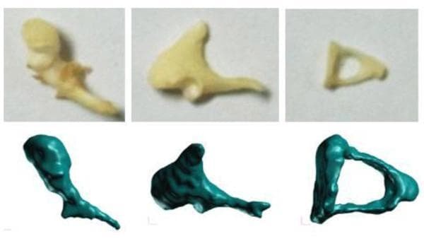 A comparison chart showcasing the three human auditory ossicles of the middle ear: the malleus (left), incus (center), and stapes (right). The image is organized into two rows to contrast real anatomical specimens with digital reconstructions. The top row features clinical photographs of actual ossicles harvested from a temporal bone, displaying natural biological variations in off-white to tan bone color, subtle surface textures, and fine morphology. The bottom row presents corresponding 3D solid models, likely generated via micro-CT scanning for finite element (FE) modeling. These digital renderings are depicted in a uniform teal color with smoothed surfaces and idealized geometries. The malleus is shown with its distinct bulbous head and elongated manubrium; the incus displays its characteristic body and short and long processes; and the stapes is identified by its small, stirrup-like triangular shape and central opening. This visual aid is designed for advanced medical education in otorhinolaryngology and biomechanical engineering, illustrating the translation of complex anatomical structures into simplified computational models for middle ear research.