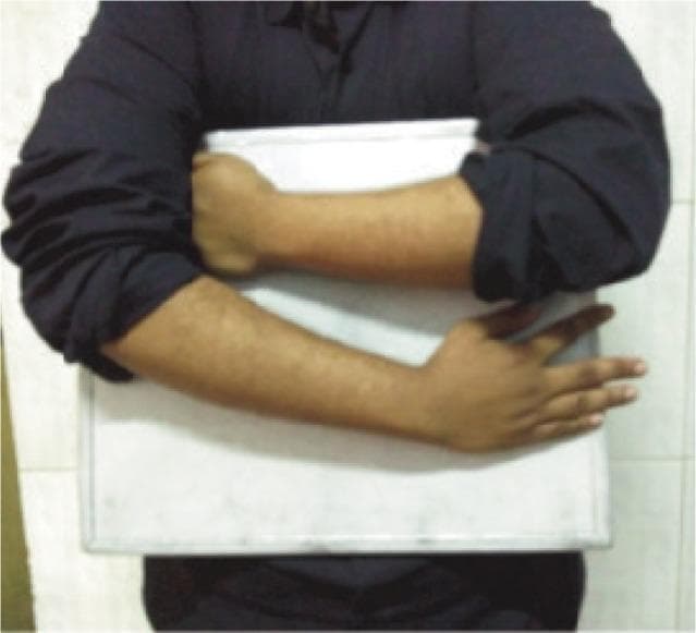 This clinical photograph demonstrates a specific patient positioning technique for simultaneous anteroposterior (AP) radiography of both forearms. The patient is shown holding a white rectangular radiographic cassette against their chest. The positioning involves internal rotation at both shoulders with the forearms crossed horizontally over the cassette to achieve a consistent orientation for imaging. The left forearm is positioned superiorly with the hand clenched, while the right forearm is positioned inferiorly with the hand open and fingers extended against the edge of the cassette. This specialized technique is utilized in orthopedics and radiology to assess bilateral radial bow and forearm anatomy, particularly in patients with limited supination. By ensuring identical positioning, clinicians can more accurately calculate the location of maximum radial bow and compare measurements between the radius and ulna without overlapping shadows, facilitating precise diagnostic evaluation of forearm deformities or injuries.