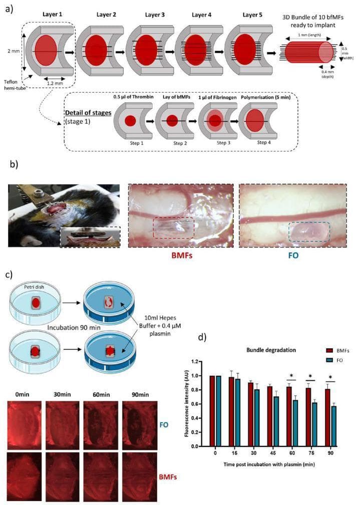 Educational diagram and experimental results depicting the fabrication and enzymatic degradation of a neuroprosthetic fibrin-based implant. Panel (a) illustrates a layer-by-layer construction process within a Teflon hemi-tube, alternating thrombin (0.5 µL) and fibrinogen (1 µL) with biofunctionalized microfibers (BMFs) to create a 3D bundle measuring approximately 1 x 0.5 x 0.4 mm. Panel (b) shows bright-field clinical photographs of the implant being positioned within a spinal cord lesion cavity in an animal model, comparing BMFs to Fibrin Only (FO) controls. Panel (c) details the in vitro fibrinolysis assay where implants are immersed in plasmin/HEPES buffer; fluorescence microscopy images track the degradation of sulforhodamine B-labeled fibrin over 90 minutes. Panel (d) provides a line graph showing normalized fluorescence intensity, demonstrating that the inclusion of microfibers (BMFs) significantly slows fibrin degradation compared to FO implants (p < 0.05), indicating enhanced structural stability in the presence of enzymatic plasmin.