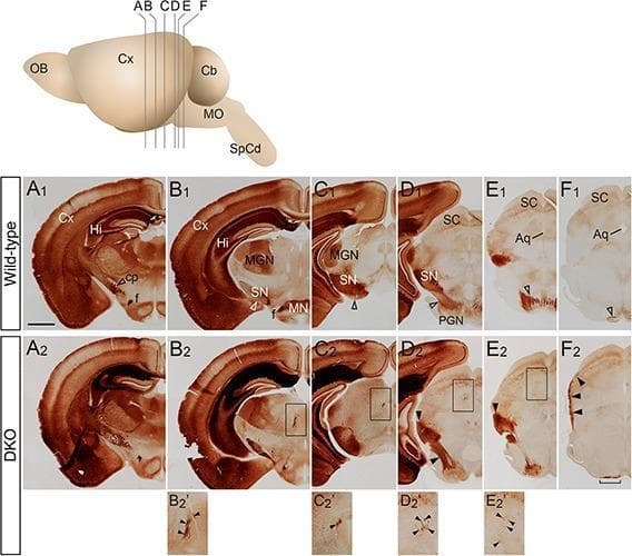 This diagnostic image series presents a comparative neuroanatomical study of the corticospinal tract (CST) using PKCΞ³-stained coronal sections of adult brains. The top panel provides an anatomical diagram showing the sectioning planes (AβF) from the cerebral cortex (Cx) through the midbrain to the medulla oblongata (MO). The main panel compares wild-type (A1βF1) with Sulf1/2 double knockout (DKO) (A2βF2) specimens. Normal CST fibers are visible in the wild-type sections as discrete staining in the cerebral peduncle (cp) and descending medially toward the pons (PGN). In the DKO specimens, significant axonal pathfinding errors are evident. Key pathologies demonstrated include misdirected fibers projecting dorsally onto the midbrain surface (E2βF2, filled arrowheads) and ectopic fibers traversing the thalamus toward the superior colliculus (SC), highlighted in high-magnification inserts (B2'βE2'). Additionally, the DKO pyramidal tract appears thinned and widened (F2, bracket) compared to the wild-type control. These findings illustrate the role of sulfatase enzymes in regulating the precise guidance of descending motor pathways during neurodevelopment.