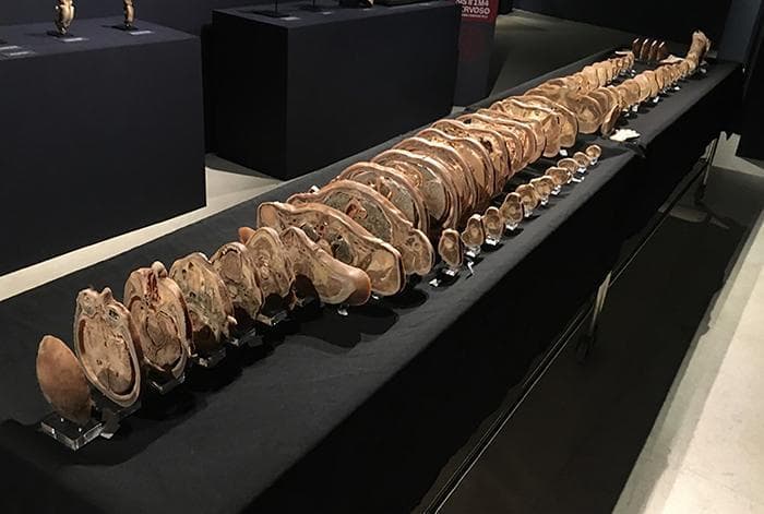 This clinical educational image displays a plastinated human specimen prepared using the von Hagens technique, arranged as a 'body tomography.' The specimen consists of numerous thin, transverse cross-sectional slices of a human body, positioned linearly along a horizontal table covered in black cloth. Each slice is held vertically by a transparent acrylic stand, allowing for a sequential view of human anatomy from the head through the trunk and limbs. The slices exhibit well-preserved internal structures with distinct anatomical morphology, including skeletal muscle, cortical and medullary bone, and visceral organs (such as the liver, heart, and lungs). The color palette is predominantly beige and brown, characteristic of silicone-impregnated tissues. This display serves as a high-fidelity anatomical model, illustrating spatial relationships between structures and tissue types in a manner analogous to radiological cross-sections like CT or MRI scans. It is used primarily for anatomical education, surgical training, and medical museum exhibition to demonstrate the three-dimensional complexity of the human body through two-dimensional physical planes.