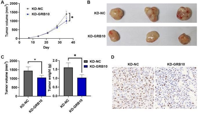 This composite image summarizes an in vivo study on the role of GRB10 in gastric cancer tumor growth using a mouse xenograft model. Panel A presents a tumor growth curve over a 35-day period, showing that the GRB10-knockdown (KD-GRB10) group exhibits significantly lower tumor volumes (mm³) compared to the control (KD-NC) group starting around day 28. Panel B displays clinical photographs of excised subcutaneous tumors, visually confirming that the KD-GRB10 tumors are smaller and more uniform than the larger, more irregular KD-NC tumors. Panel C provides bar graphs quantifying final tumor volume and weight (g), indicating a statistically significant reduction in both parameters for the knockdown group (*p < 0.05). Panel D shows Ki67 immunohistochemical staining of tumor sections; the KD-GRB10 group demonstrates a markedly lower density of brown-stained nuclei compared to the KD-NC group, indicating reduced cellular proliferation. The findings collectively demonstrate that GRB10 knockdown inhibits gastric cancer progression and proliferative activity in vivo.