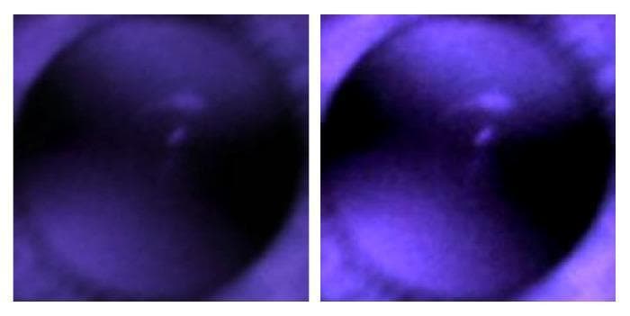 This diagnostic image pair displays infrared (IR) red reflex images of a human pupil, utilized in ophthalmology for assessing refractive errors like myopia and hyperopia. The side-by-side comparison demonstrates the effect of digital image processing on clinical diagnostic data. The left image shows the raw IR capture with lower brightness and diffused contrast. The right image illustrates the same pupil after increasing contrast, which enhances the visibility of crescent-shaped light reflections (photorefractive crescents) within the pupillary aperture. These crescents are critical clinical markers; their morphology and spatial distribution (merged vs. far apart) are used to predict spherical power and refractive state. The images were captured using a non-mydriatic handheld fundus camera, which allows for anterior segment viewing without inducing pupillary constriction. This visual comparison highlights how contrast adjustment can clarify diagnostic features for both manual clinical grading and deep-learning-based AI classification in vision screening.