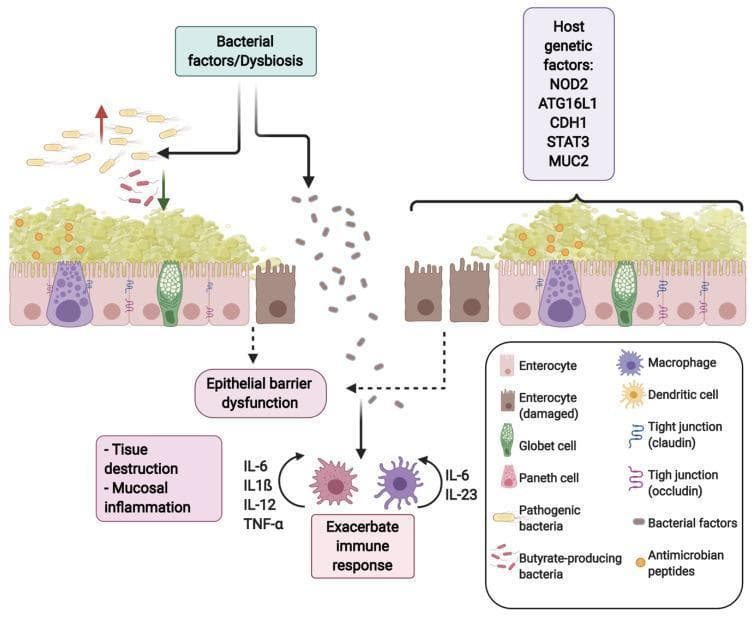 This pathophysiology diagram illustrates the mechanisms of intestinal epithelial barrier dysfunction and mucosal inflammation, typically associated with Inflammatory Bowel Disease (IBD). The visual is divided into a comparative study of barrier integrity. The intestinal lining features enterocytes (pink), goblet cells (green), and Paneth cells (red). A functional barrier maintains tight junctions (claudin and occludin) and a healthy microbiome. In contrast, the segment showing dysfunction depicts damaged enterocytes (brown), loss of tight junction integrity, and gut dysbiosis characterized by a decrease in butyrate-producing bacteria and an increase in pathogenic bacteria. The diagram highlights 'Host genetic factors' (e.g., NOD2, ATG16L1, MUC2) and 'Bacterial factors' as primary drivers of this defect. Translocation of bacterial components across the compromised epithelium triggers an 'Exacerbate immune response' involving macrophages and dendritic cells. This leads to the secretion of pro-inflammatory cytokines such as IL-6, IL-1β, IL-12, IL-23, and TNF-α, ultimately resulting in tissue destruction and chronic mucosal inflammation.