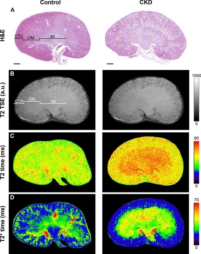This multi-panel figure compares renal histology and magnetic resonance imaging (MRI) between a control kidney and a Chronic Kidney Disease (CKD) model. Row A presents Hematoxylin & Eosin (H&E) stained sections, highlighting the renal cortex (CTX), outer medulla (OM), and inner medulla (IM). In the CKD kidney, there is visible cortical thinning and loss of clear structural demarcation between medullary layers. Row B displays T2-weighted Turbo Spin Echo (TSE) images, showing morphological changes and signal intensity variations corresponding to the tissue layers. Rows C and D provide functional mapping through T2 and T2* relaxation time maps using pseudo-color scales (0-80ms and 0-70ms respectively). These maps demonstrate significantly elevated relaxation times in the CKD kidney, particularly within the outer medulla, visualized by a shift from cooler green/blue tones to warmer yellow/red tones. The composite image illustrates the correlation between histological tissue remodeling and functional MRI biomarkers in renal pathology.