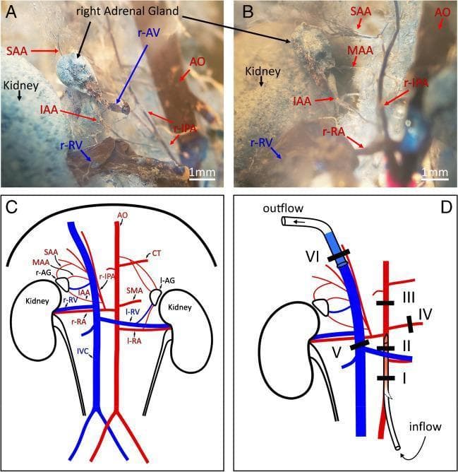This composite figure illustrates the vascular anatomy of the right adrenal gland in a mouse model, utilizing vascular corrosion casting and schematic diagrams. Panels A and B present close-up views of a vascular corrosion cast (plastination), demonstrating the 3D arterial architecture. The right adrenal gland receives its blood supply from the right inferior phrenic artery (r-IPA), which branches into three distinct vessels: the superior (SAA), middle (MAA), and inferior (IAA) adrenal arteries. The relationship between the aorta (AO), renal artery (r-RA), and the kidney is visible. Panel C provides a labeled anatomical diagram of the retroperitoneal vasculature, including the inferior vena cava (IVC), renal veins (r-RV, l-RV), celiac trunk (CT), and superior mesenteric artery (SMA). Panel D details a surgical ligation and perfusion protocol, showing strategic placement of six ligatures (I-VI) and catheters to isolate the right adrenal gland for physiological study. This resource is designed for advanced biomedical research and comparative anatomy, focusing on endocrine organ microvasculature and ex vivo organ perfusion techniques.