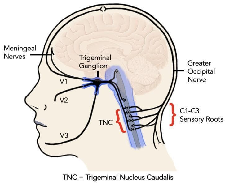 Anatomical diagram in a sagittal profile illustrating the neuroanatomy of the trigeminocervical complex and its primary sensory pathways. The central focus is the trigeminal ganglion, showing the three major divisions of the trigeminal nerve (CN V): the ophthalmic nerve (V1) innervating the forehead and eye region, the maxillary nerve (V2) serving the mid-face, and the mandibular nerve (V3) supplying the lower jaw. Superiorly, the meningeal nerves are shown branching toward the intracranial space. Posteriorly, the diagram highlights the convergence of trigeminal and cervical sensory inputs in the brainstem and upper spinal cord, specifically at the Trigeminal Nucleus Caudalis (TNC). The TNC is shown receiving afferent fibers from the trigeminal nerve as well as the C1-C3 sensory roots. Additionally, the greater occipital nerve is depicted at the posterior cranium. This illustration demonstrates the structural basis for referred pain mechanisms and central sensitization in conditions like migraine and other primary headache disorders by showing the functional integration of cranial and upper cervical sensory information.