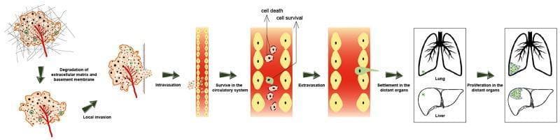 This pathophysiology diagram illustrates the sequential steps of the cancer metastatic cascade. The process begins with a primary tumor mass and progresses through the degradation of the extracellular matrix and basement membrane, followed by local invasion into surrounding tissues. The diagram depicts intravasation, where cancer cells enter the circulatory system. Within the vasculature, the image distinguishes between cell death and cell survival pathways. Surving circulating tumor cells are shown undergoing extravasation to exit the blood vessel. The final stages include the settlement of these cells in distant organs, specifically visualized in the lungs and liver. The diagram concludes by showing the proliferation of these cells into secondary metastatic tumors within those organs. This educational visual provides a comprehensive overview of oncology concepts related to tumor progression, hematogenous spread, and organ-specific metastasis for medical students and oncology professionals.