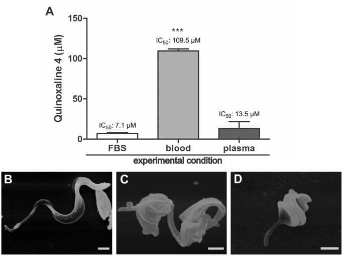 Educational figure regarding the anti-parasitic activity of quinoxaline 4 against Trypanosoma cruzi trypomastigotes. Panel A is a comparison bar chart illustrating the effective concentration (EC50) of the compound under three experimental conditions: fetal bovine serum (FBS), whole mouse blood, and mouse plasma. The Y-axis measures concentration in micromolar (µM). Results show a significant increase in EC50 when blood is present (109.5 µM) compared to FBS (7.1 µM) or plasma (13.5 µM), suggesting compound interaction with blood cells. Panels B-D are scanning electron microscopy (SEM) images demonstrating morphological changes in the parasite. Panel B shows a control trypomastigote with a characteristic elongated, slender body and prominent flagellum. Panels C and D show parasites treated with IC50 and IC90 concentrations, respectively, exhibiting marked pathological alterations including cell body shortening, widening, and loss of typical undulating morphology. Scale bars represent 1 µm. This content is relevant to parasitology and infectious disease pharmacology research.