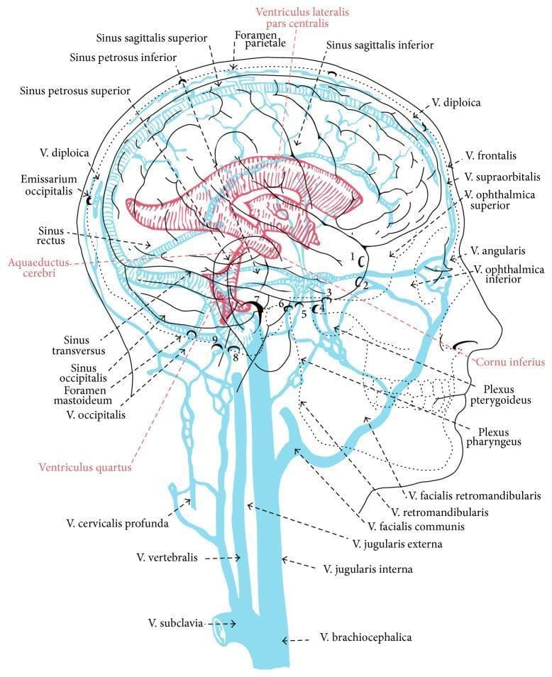 This medical anatomical diagram provides a sagittal view of the human head and neck, illustrating the interconnected dural venous sinus system, the cerebral ventricular system, and the extracranial venous drainage. Key vascular structures highlighted in blue include the sinus sagittalis superior and inferior, sinus rectus, sinus transversus, and sinus occipitalis. The diagram details the transition from intracranial dural sinuses to extracranial pathways, such as the V. jugularis interna, V. vertebralis, and V. brachiocephalica. Additionally, it displays the relationship between the dural sinuses and facial/orbital veins (e.g., V. ophthalmica superior, V. angularis). Overlaid in red is the ventricular system, clearly labeling the ventriculus lateralis, aquaeductus cerebri, and ventriculus quartus, demonstrating the spatial orientation of cerebrospinal fluid pathways relative to the major venous structures. Anatomical landmarks such as the foramen parietale and foramen mastoideum are indicated to show where emissary veins (V. diploica) bridge the intracranial and extracranial compartments. This educational illustration is designed to teach the complex neurovascular anatomy of cranial drainage and ventricular positioning.