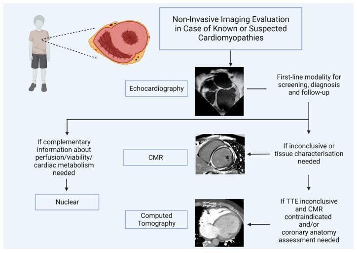 A medical diagnostic flowchart titled 'Non-Invasive Imaging Evaluation in Case of Known or Suspected Cardiomyopathies,' specifically focused on the pediatric population. The algorithm outlines a sequential clinical pathway starting with Echocardiography as the first-line modality for screening, diagnosis, and follow-up. The pathway branches into three secondary modalities based on clinical needs: (1) Cardiac Magnetic Resonance (CMR) is indicated if echocardiography is inconclusive or if tissue characterization is required. (2) Computed Tomography (CT) is selected if Transthoracic Echocardiography (TTE) is inconclusive and CMR is contraindicated, or for specific coronary anatomy assessment. (3) Nuclear imaging is utilized when complementary information regarding myocardial perfusion, viability, or cardiac metabolism is needed. Each modality is paired with a representative clinical image: a 4-chamber echocardiogram view, a short-axis CMR slice, and a cardiac CT scan. A supporting anatomical illustration of a child and a cross-sectional heart diagram (showing hypertrophy/dilation) emphasizes the pediatric cardiology context. The diagram serves as an educational guide for optimizing imaging selection in cardiomyopathies like HCM, DCM, and LVNC.