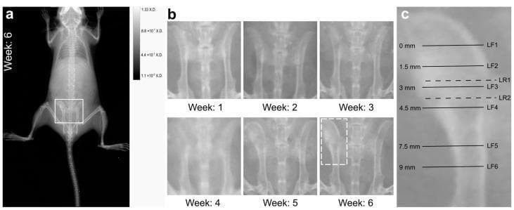 This figure demonstrates diagnostic imaging findings and a longitudinal progression of hematogenous osteomyelitis in a preclinical mouse model. Panel (a) shows a whole-body X-ray at 6 weeks post-infection, with a region of interest (ROI) highlighted over the pelvis. Panel (b) presents a series of weekly pelvic X-rays from Week 1 to Week 6. The progression shows stable bone architecture until Week 5, followed by significant pathological changes at Week 6, characterized by severe bone deformation, cortical thickening, and increased radiopacity of the left ilium, consistent with chronic osteomyelitis. The right pelvis remains relatively normal on 2D imaging. Panel (c) provides a high-magnification view of the affected left pelvis with annotated planes (LF1–LF6 and LR1–LR2) ranging from 0mm to 9mm. These markers indicate the precise anatomical locations used for subsequent cryo-sectioning, immunofluorescence staining, and Raman spectroscopic imaging to analyze staphylococcal abscess communities (SACs) and reactive bone formation. The content illustrates the macroscopic manifestations of chronic bone infection and the methodological approach for correlating clinical imaging with microscopic tissue analysis.