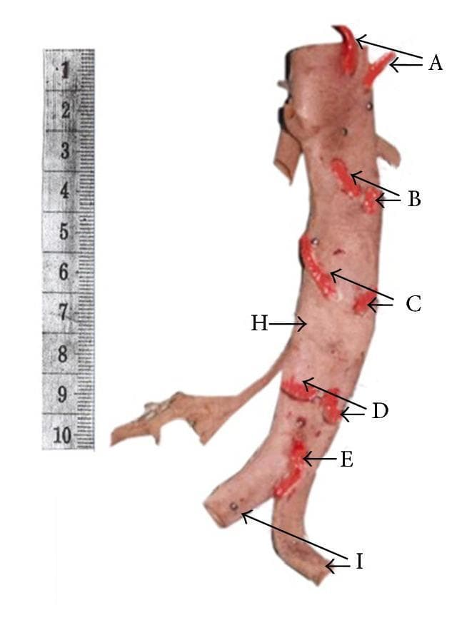 This clinical photograph displays a posterior view of a dissected and fixed human abdominal aorta (labeled H), showcasing the typical origin and spatial distribution of its dorsal parietal branches. Four pairs of lumbar arteries (labeled A through D) are identified sequentially from superior to inferior, emerging laterally from the posterior aspect of the aortic wall at regular intervals. Each lumbar artery has been highlighted in red to clearly delineate its origin and initial course. Distally, the median sacral artery (labeled E) is visible as an unpaired vessel arising from the posterior surface of the aorta just proximal to its bifurcation into the left and right common iliac arteries (labeled I). A 10-centimeter metric scale is positioned adjacent to the specimen to provide a reference for the anatomical dimensions. This image serves as an educational resource for studying vascular anatomy, surgical landmarks for posterior abdominal wall procedures, and potential variations in the branching patterns of the aorta's posterior segment.