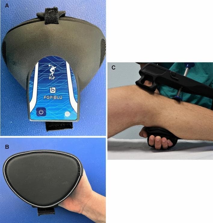 Educational panel illustrating the components and clinical application of an arthrometry system for assessing knee ligament laxity. Images A and B show the accessory Bluetooth-connected dynamometer, which features a teardrop-shaped ergonomic housing with a blue control panel (labeled FGP BLU), a power icon, an LED indicator, and integrated Velcro straps for secure attachment. The reverse side (B) displays a padded, hand-contoured interface with a white-bordered perimeter. Image C demonstrates the clinical use of the system during a physical examination (such as a Lachman test). The arthrometer is positioned atop the patient's flexed knee with supports on the patella and distal tibia, while the examiner applies anterior traction to the proximal tibia. The examiner holds the accessory dynamometer against the posterior aspect of the patient's leg, allowing the system to concurrently quantify applied force and anterior tibial translation in millimeters. This setup is designed to provide objective data for diagnosing anterior cruciate ligament (ACL) injuries and monitoring knee joint stability.