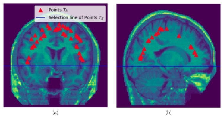 This diagnostic image illustrates brain sampling points (TB) for segmentation methodology using MRI data. The figure is divided into two panels: (a) a coronal section and (b) a sagittal section of the human brain. Both images utilize a teal-to-green false-color scale for anatomical visualization. In panel (a), the coronal view displays the cerebral cortex, ventricular system, and basal ganglia. In panel (b), the sagittal view reveals the cortex, cerebellum, brainstem, and corpus callosum. A horizontal blue 'selection line' bisects both images at the level of the lateral ventricles. Red triangle markers, labeled as 'Points TB,' are distributed above this selection line, primarily localized within the cortical gray matter and subcortical regions. This visual demonstrates the spatial distribution of sampling nodes used in graph-based brain segmentation algorithms to distinguish brain tissue from non-brain structures and the skull. The educational focus is on neuroimaging processing and computational anatomy.