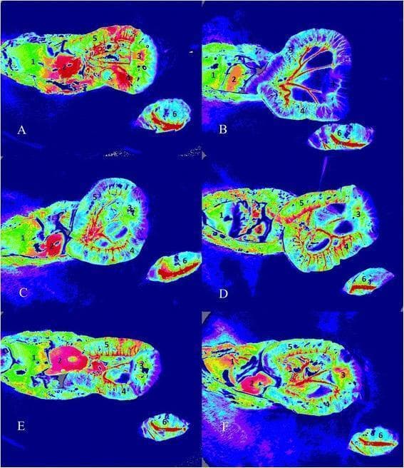 This diagnostic image set showcases Laser Speckle Contrast Imaging (LSCI) used to evaluate microcirculatory blood flow intensity in an animal model of hemorrhagic shock and resuscitation. Six pseudo-colored panels (A-F) represent different experimental groups: sham (a), control (b), 0.9% saline (c), hypertonic saline (d), gelatin (e), and hydroxyethyl starch (f) at time point T2. The color scale indicates blood flow intensity, where red and yellow represent higher perfusion, green intermediate, and blue/purple lower perfusion. Each panel identifies six distinct anatomical regions of interest (ROIs): (1) liver, (2) kidney, (3) intestinal mucosa, (4) serosal muscular layer, (5) Peyer's patch, and (6) gracilis muscle. The comparison highlights significant perfusion deficits in the control and saline groups (cooler tones in kidney and intestine) versus the restoration of microcirculatory flow in groups resuscitated with hypertonic saline or colloids (warmer tones). This visualization is essential for understanding splanchnic organ perfusion and the efficacy of different fluid resuscitation strategies in critical care medicine.