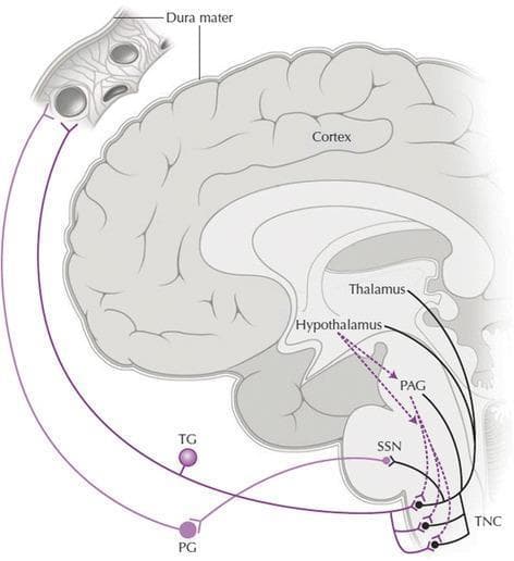 A medical schematic diagram depicting the pathophysiology of the trigeminal-autonomic reflex in a sagittal section of the human brain. The illustration highlights the neural pathways involved in primary headache disorders, such as cluster headaches. Key labeled anatomical structures include the dura mater, cerebral cortex, thalamus, and hypothalamus. Within the brainstem, specific nuclei are identified: the periaqueductal grey (PAG), superior salivatory nucleus (SSN), and trigeminal nucleus caudalis (TNC). Peripheral structures shown include the trigeminal ganglion (TG) and ptyrogopalatine (sphenopalatine) ganglion (PG). Solid purple lines illustrate sensory afferent connections from cranial structures synapsing at the TNC, and its subsequent reflexive connections to the TG and PG. Dashed purple lines represent descending modulatory hypocretinergic projections from the hypothalamus to the PAG and TNC. Black lines indicate the relay of sensory information from the TNC to the thalamus and cortex. This diagram serves as an educational tool for understanding nociceptive processing and autonomic activation in the trigeminal system.
