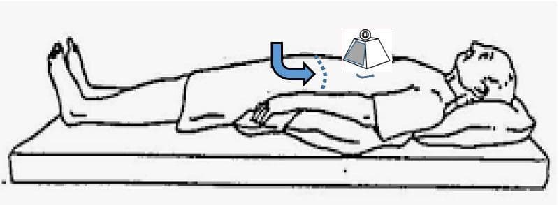 This medical illustration demonstrates maneuvers used for the local modification of chest wall compliance in patients with severe respiratory distress, such as late-phase COVID-19 ARDS. The diagram shows a patient in a supine position on a flat examination surface. Two distinct clinical interventions are illustrated: 1) Sternal weighting, represented by a physical weight placed directly over the sternum to apply downward compressive force; and 2) A 'belly push' maneuver, indicated by a curved blue arrow showing sustained downward and inward pressure applied to the mid-upper abdomen. These external forces aim to modify respiratory system mechanics by reducing end-expiratory lung volumes, potentially shifting the lung's operation to a more compliant portion of the pressure-volume curve. This technique is used to assess or improve tidal compliance and reduce driving pressures during passive volume-targeted ventilation. The educational focus is on pathophysiology and critical care ventilation strategies to avoid end-tidal overdistention in 'baby lungs' associated with severe ARDS.