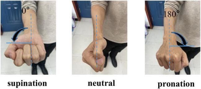 A sequence of three clinical photographs demonstrating the range of motion for forearm rotation, specifically focusing on the degrees of freedom in pronation and supination. Each image shows a human forearm and fist with superimposed geometric annotations. Left panel (Supination): The forearm is in a fully supinated position with the palm/anterior surface facing upward, labeled as 0"". Middle panel (Neutral): The forearm is in the mid-position (neutral), with the thumb pointing upward and the radial side of the hand superior. Right panel (Pronation): The forearm is in a fully pronated position with the dorsal surface of the hand facing upward, labeled as 180"". Dotted vertical lines and curved arrows illustrate the angular displacement and direction of rotational movement. This visual is designed for orthopedic or kinesiologic education, illustrating the clinical assessment of the radio-ulnar joints and the physiological limits of forearm rotation for prosthetic or exoskeleton development.
