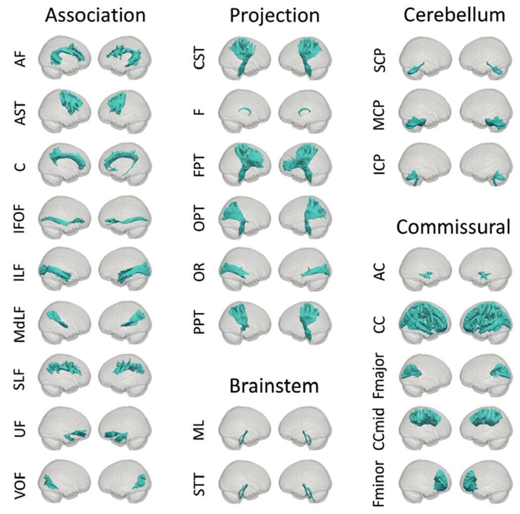 An anatomical diagram from the IIT Human Brain Atlas v.5.0 illustrating major white matter fiber bundles. The visualization is organized into a grid categorized by functional white matter types: Association, Projection, Cerebellum, Brainstem, and Commissural. Each specific tract is represented by teal-colored streamlines overlaid on a semi-transparent gray 3D brain model, shown from two perspective views to indicate spatial trajectory. Association fibers, such as the Arcuate Fasciculus (AF) and Cingulum (C), demonstrate curvilinear paths connecting cortical regions within the same hemisphere. Projection fibers, including the Corticospinal Tract (CST) and Frontopontine Tract (FPT), exhibit vertical orientations connecting the cortex to subcortical structures. Cerebellar and brainstem sections show localized pathways like the Superior Cerebellar Peduncle (SCP) and Medial Lemniscus (ML). Commissural tracts, such as the Corpus Callosum (CC) and Anterior Commissure (AC), show interhemispheric connectivity. This diagram serves as a neuroanatomical reference for white matter connectivity, tractography, and neuroimaging atlas interpretation.