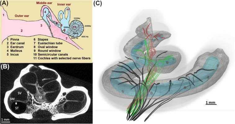 Educational composite detailing human ear anatomy and cochlear mechanics. Panel (A) is an anatomical diagram of the outer, middle, and inner ear, highlighting the conduction pathway from the pinna (1) and ear canal (2) to the ossicles (4-6) and the tonotopic frequency mapping of the cochlea (11). Panel (B) is a high-resolution cross-sectional diagnostic image of the cochlea, identifying the scala vestibuli (SV), scala media (SM), and scala tympani (ST), alongside the central modiolus (M) and Rosenthal’s canal (RC). Panel (C) presents a 3D pathophysiology diagram illustrating the tonotopic organization of auditory nerve fibers: basal (black), middle (green), and apical (red) turns. A light blue 12-channel cochlear implant electrode array is shown inserted into the translucent scala tympani. This visual content illustrates the relationship between cochlear microanatomy and medical device placement for treating hearing loss. Scale bars of 1 mm are provided for anatomical reference.