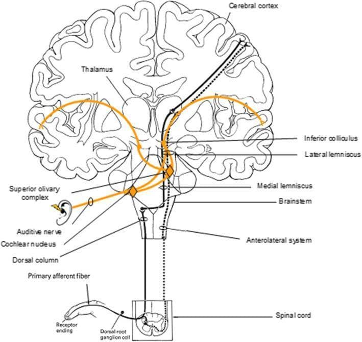 A pathophysiology diagram illustrating the ascending sensory pathways from the periphery to the cerebral cortex. The schematic uses a coronal section of the human brain, brainstem, and spinal cord to trace three major systems: the auditory-lateral lemniscal system (solid orange line), the dorsal column-medial lemniscus system (solid black line), and the anterolateral system (dashed black line). The auditory pathway is traced from the ear through the auditive nerve, cochlear nucleus, superior olivary complex, lateral lemniscus, and inferior colliculus, relaying through the medial geniculate nucleus of the thalamus to the auditory cortex. Somatosensory pathways are traced from receptor endings in the finger through the dorsal root ganglion to the spinal cord. The dorsal column system ascends ipsilaterally before decussating in the medulla (medial lemniscus) and relaying via the thalamus to the somatosensory cortex. The anterolateral system decussates at the spinal level before ascending. This visual summarizes the functional neuroanatomy required for sensory reactivity, commonly assessed in electroencephalography (EEG) clinical evaluations.