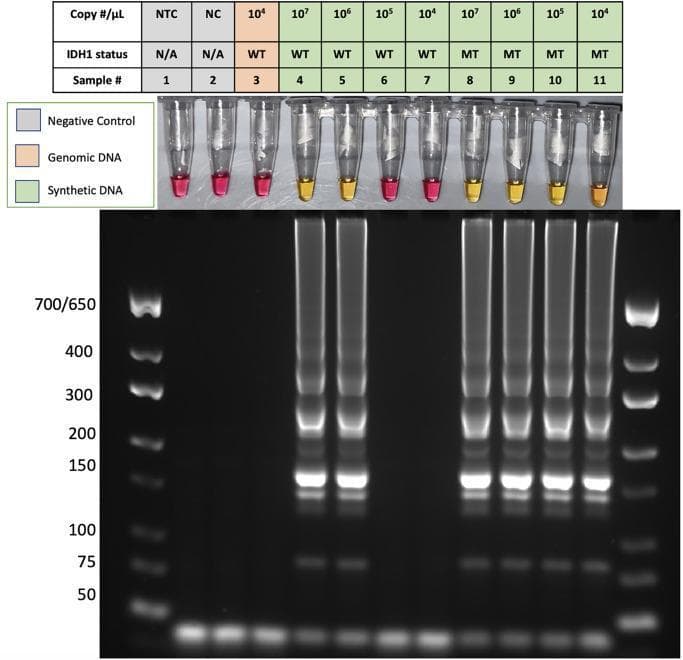 This composite diagnostic image demonstrates the specificity of a Peptide Nucleic Acid Loop-mediated Isothermal Amplification (PNA-LAMP) assay for detecting the IDH1-R132H mutation, a key biomarker in glioma. The top panel shows a colorimetric assay in eleven microtubes. A positive result for DNA amplification is indicated by a yellow color change (samples 4, 5, 8, 9, 10), while negative results remain pink (samples 1, 2, 3, 6, 7, 11). The samples include non-template (NTC) and negative controls (NC), human genomic DNA (hgDNA), and varying concentrations of synthetic wild-type (WT) and mutant (MT) DNA. The bottom panel displays the corresponding gel electrophoresis results. Positive reactions (yellow tubes) show a characteristic laddering pattern of concatemers across a wide range of molecular weights, confirming successful isothermal amplification. Negative reactions (pink tubes) show no such banding. The data illustrates how PNA successfully suppresses wild-type IDH1 amplification at concentrations ≤ 10^5, allowing for specific visual and molecular detection of the IDH1-R132H mutation.