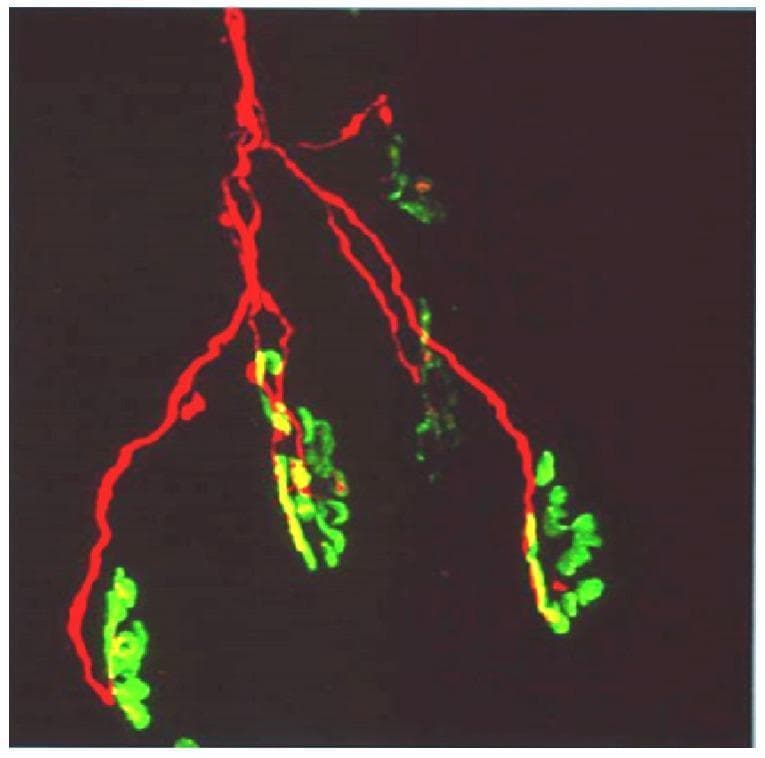 This diagnostic fluorescence microscopy image illustrates the neuromuscular junction (NMJ) architecture. The image features a single motor axon labeled with red fluorescence (TRITC-conjugated anti-neurofilament antibody), showing a characteristic distal branching pattern. These red axonal branches terminate at multiple motor end-plates, which are visualized in green (FITC-conjugated ฮฑ-bungarotoxin) to reveal the high density of postsynaptic acetylcholine receptors (AChRs). The spatial relationship demonstrates a single axon innervating a cluster of six individual end-plates. Areas of colocalization between the presynaptic nerve terminal and the postsynaptic membrane appear yellow, indicating functional synaptic contact. This visual serves as an educational model for neuroanatomy and toxicology, particularly in the study of neurotoxic snake venoms (like those from the elapid family) that target presynaptic proteins or postsynaptic receptors, leading to neuromuscular paralysis and axonal degeneration.