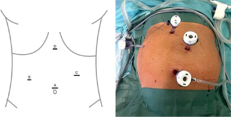 Hugging Face pmc clinical VQA raw